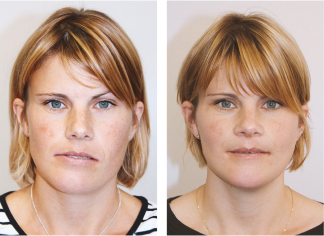 Kochada uxlayotganlarni yechish